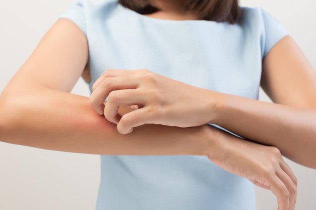 Itching on the Body: What Is It, Diagnosis, and Treatment ...