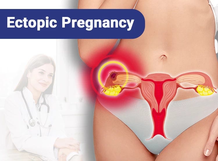 How to Detect Ectopic Pregnancy Symptoms Early? - Raadina Health