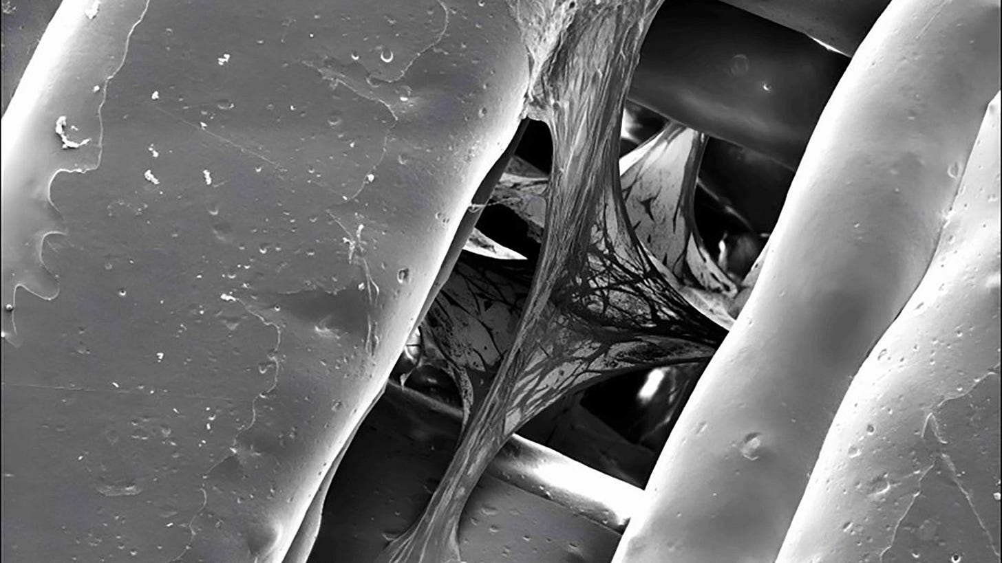 SEM-StemCellsonScaffold_1920x1080