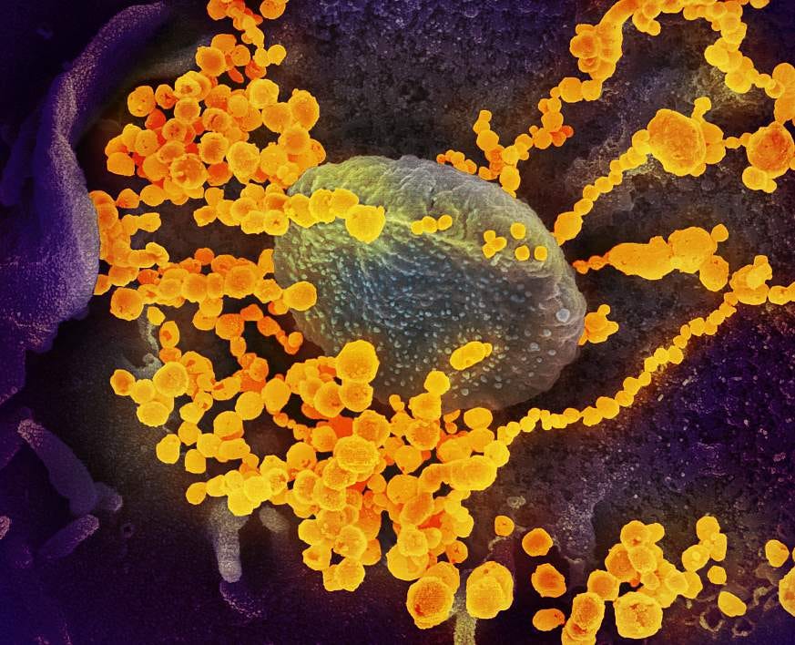 Novel Coronavirus SARS-CoV-2 Novel Coronavirus SARS-CoV-2