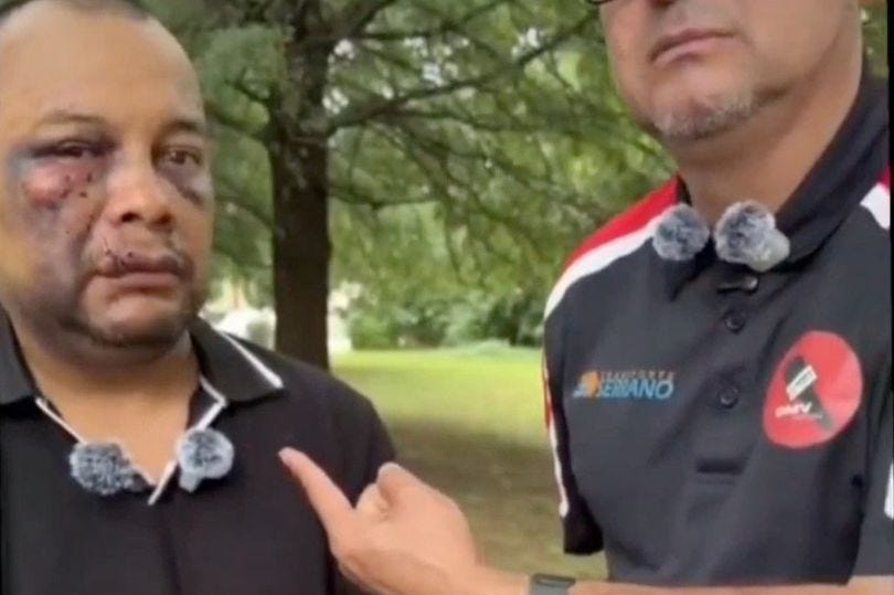 ICE refuses to remove ankle monitor for life-saving MRI after beating Virginia man to a pulp - AOL ICE refuses to remove ankle monitor for life-saving MRI after beating Virginia man to a pulp - AOL