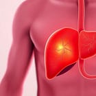 Doctors Said Fatty Liver… What Happened Next Will Shock You