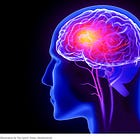 HORRIFYING! Psychosis, Panic Attacks, Hallucinations: Bizarre Psychiatric Cases Among the COVID Vaccinated