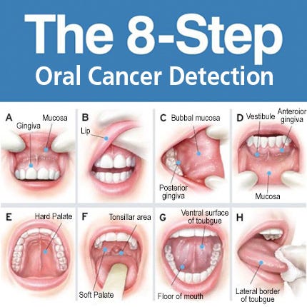 ORAL CANCER – Dr. Deshmukh Orthodontics