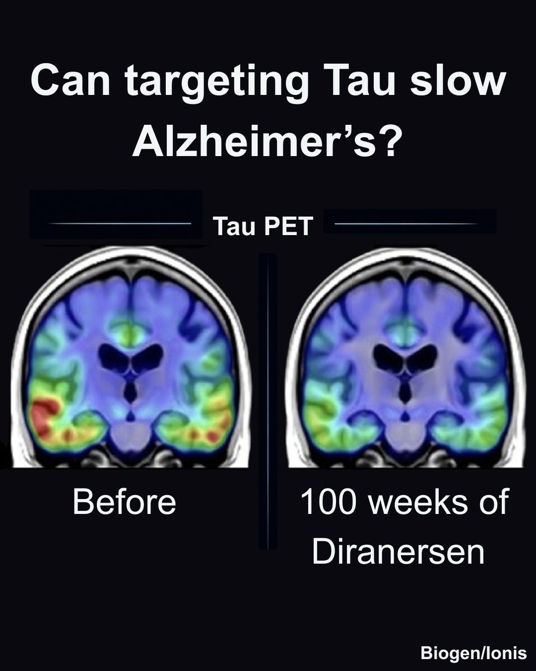 tirzepatide alzheimer's This week in medicine: guided cancer therapy, a new Alzheimer's trial, and  more