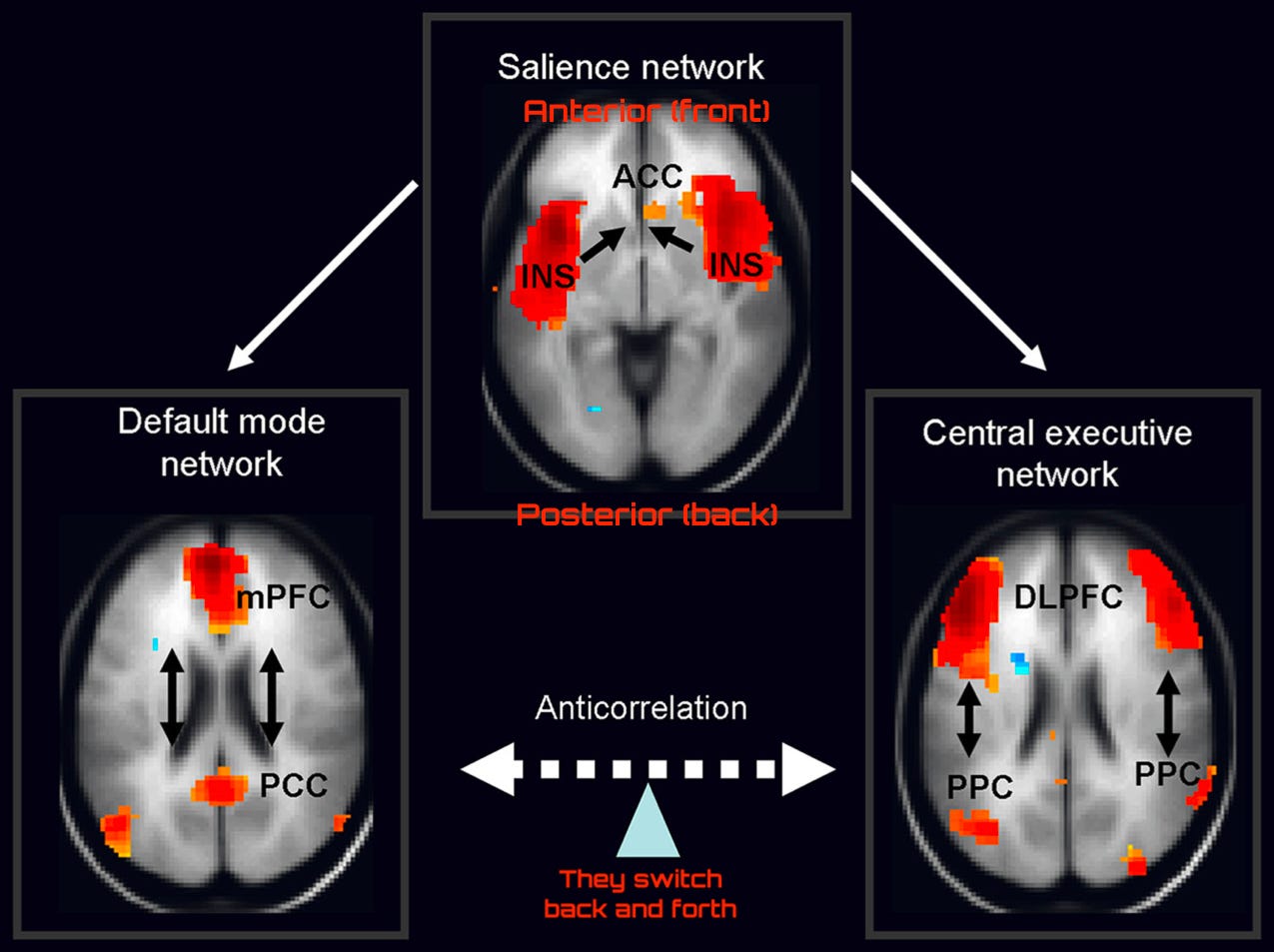 Triple Network Model And Rdoc The Triple Network Model: How the brain is either task-positive or task ...