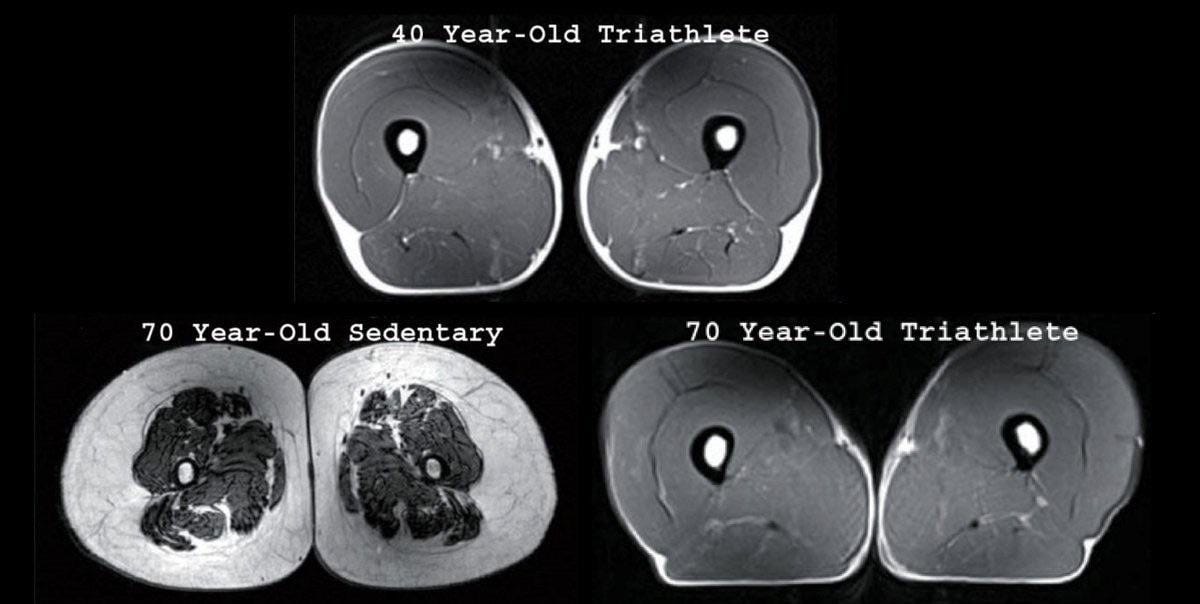 Muscle density between 40 year old triathlete vs 70 years old triathlete,  no difference. : r/Damnthatsinteresting