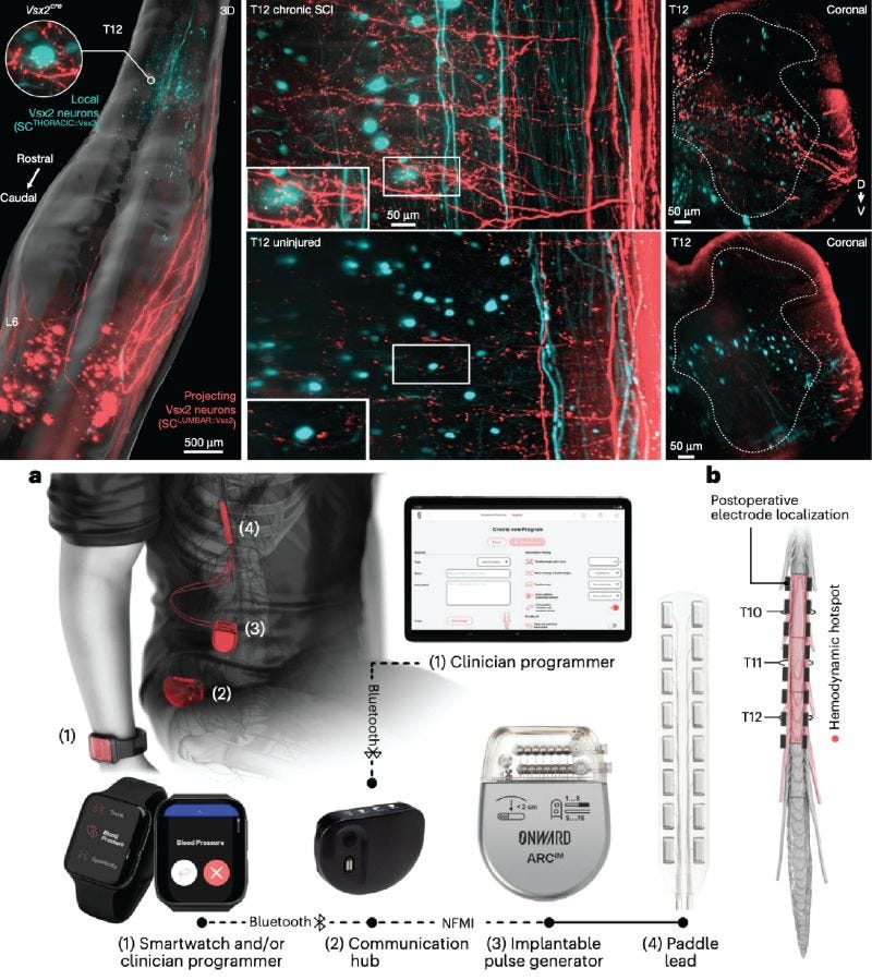 No alternative text description for this image