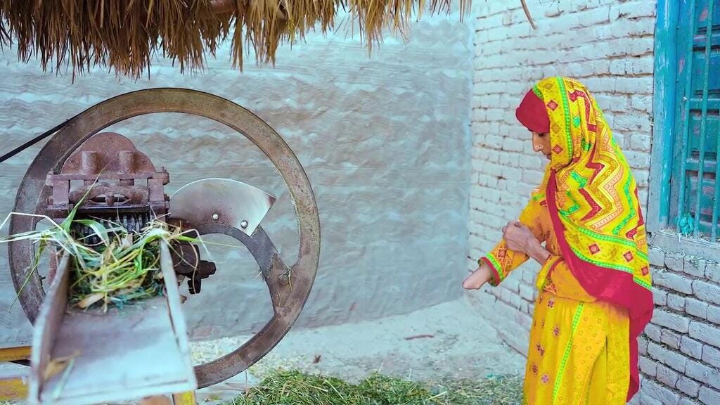 A rural Pakistani woman injured by a fodder cutter. A rural Pakistani woman injured by a fodder cutter.