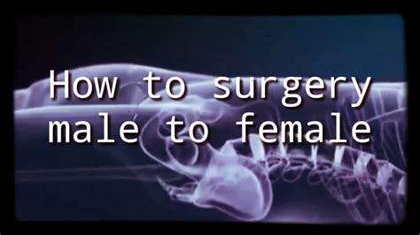 Gender Reassignment Surgery Other Term at David Montalvo blog