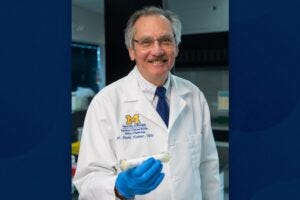 Humes holding a prototype of the Selective Cytopheretic Device developed to treat smaller pediatric patients.