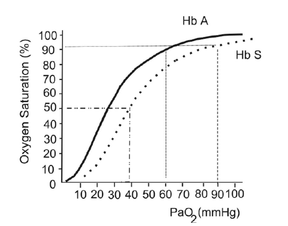 Do sickle cell and other hemoglobinopathies impact pulse oximeter ...