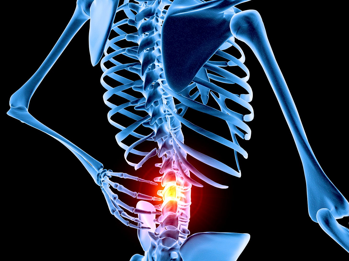 a skeleton with low back pain