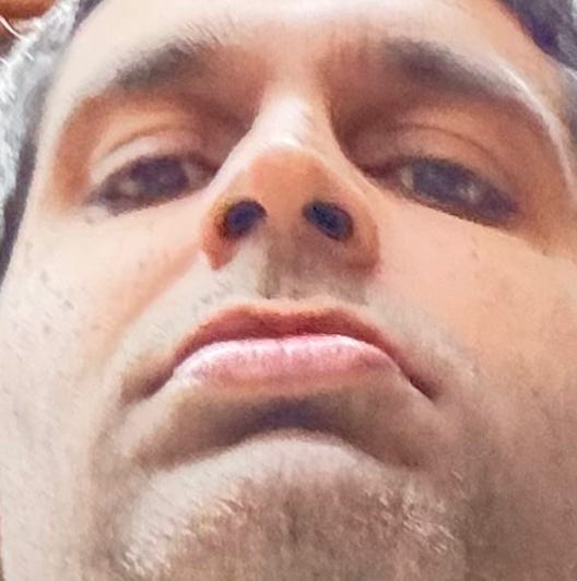 Sharath