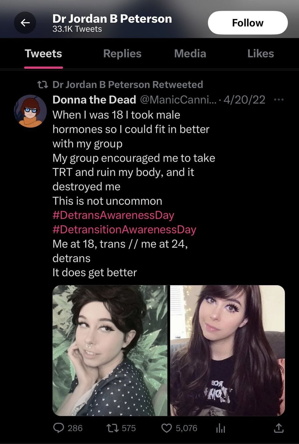 When I was 18 I took male hormones so I could fit in better with my group My group encouraged me to take TRT and ruin my body, and it destroyed me This is not uncommon #DetransAwarenessDay #DetransitionAwarenessDay Me at 18, trans // me at 24, detrans It does get better When I was 18 I took male hormones so I could fit in better with my group My group encouraged me to take TRT and ruin my body, and it destroyed me This is not uncommon #DetransAwarenessDay #DetransitionAwarenessDay Me at 18, trans // me at 24, detrans It does get better