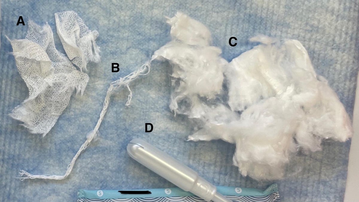 Toxic Tampons and Fertility Issues