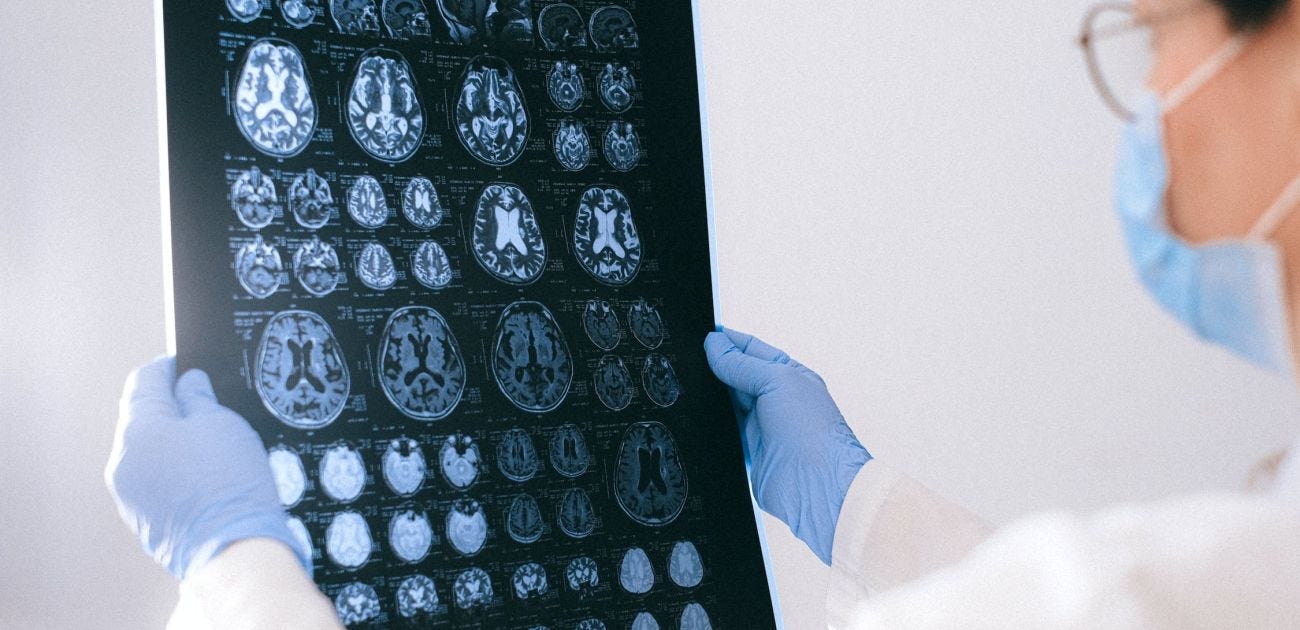 Degradación cognitiva Degradación cognitiva