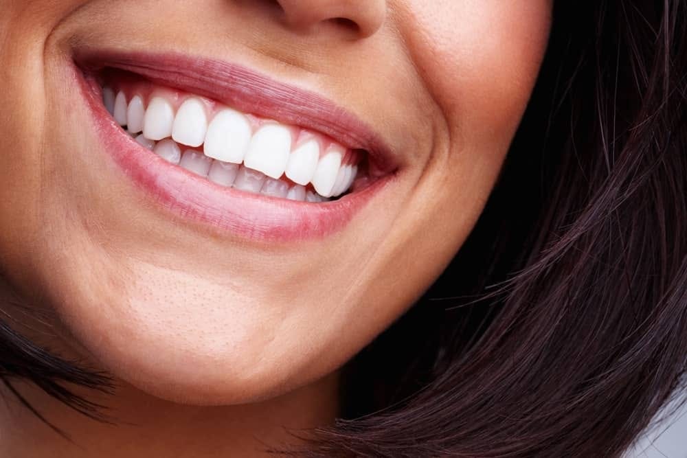 Veneers north miami fl