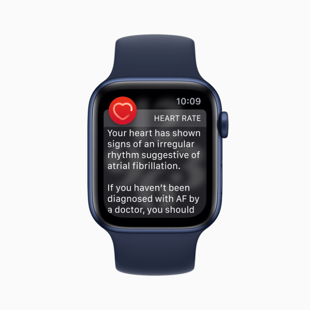 Apple Watch atrial fibrillation