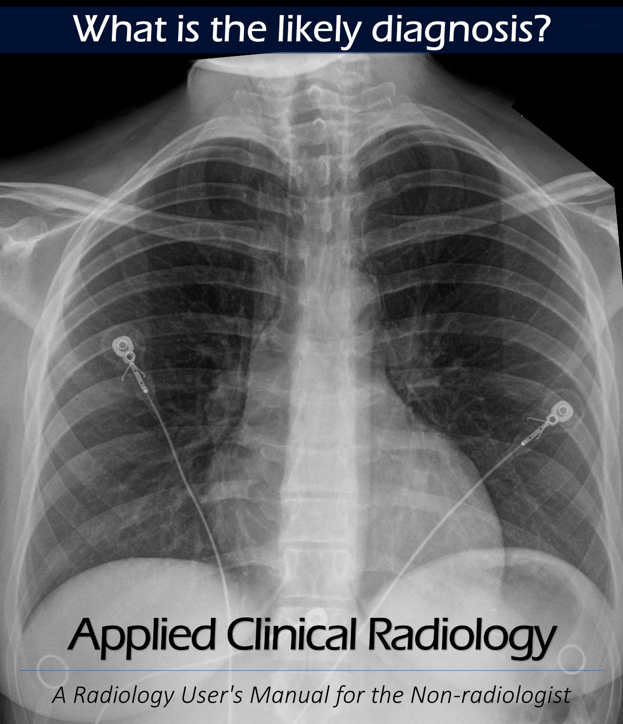 A 26-year-old female presents to her primary care clinic after a 4-week ...