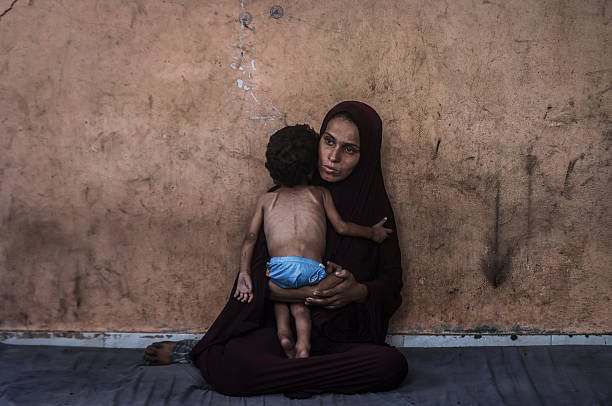 Year-old Palestinian Yezen Abu Ful, whose health has deteriorated due to lack of access to food and nutritional supplements, is seen with his mother...