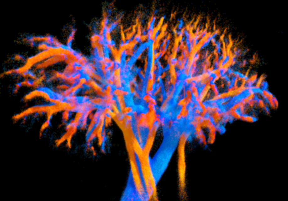 Révolution médicale : une imagerie 4D pour cartographier la circulation sanguine Révolution médicale : une imagerie 4D pour cartographier la circulation sanguine