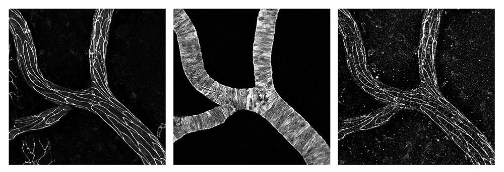 Three grayscale microscope images of the same portion of a branching blood vessel