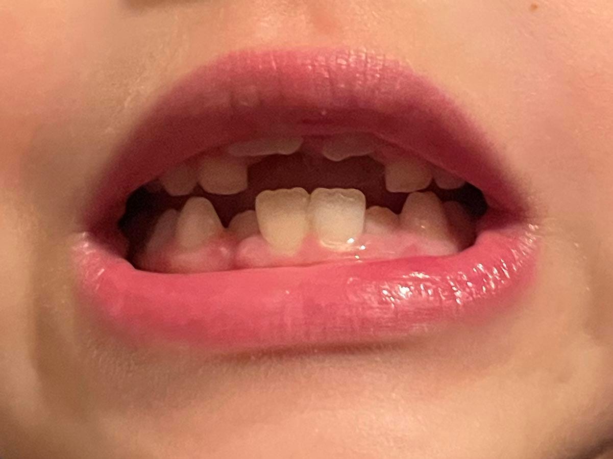 A big toothy grin from a six year old