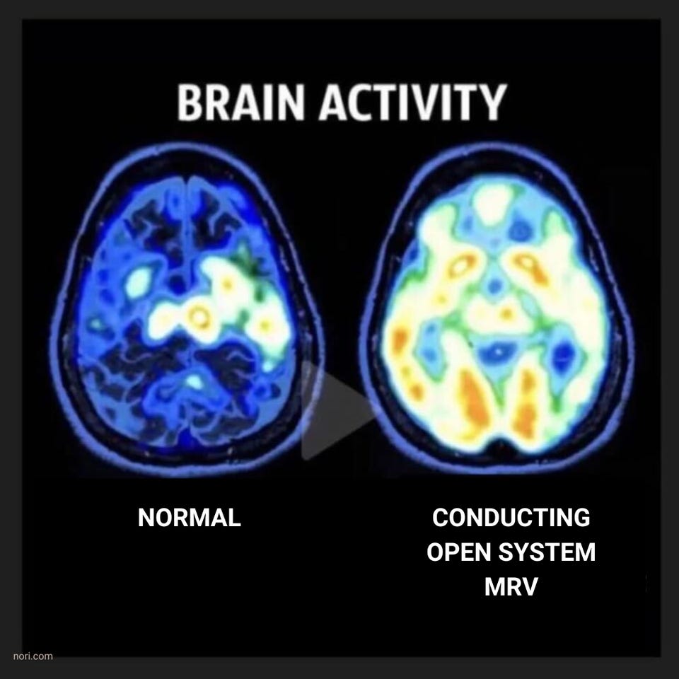 "Brain activity" comparison of two brain scans. "Normal" shows a little activity. "Conducting open system MRV" is lit up almost everywhere.