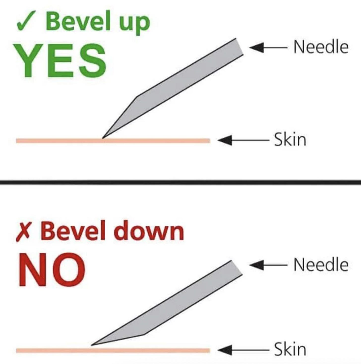 Beginners Guide to Peptide Injections 101