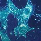 SARS-CoV-2 lasting impact in the bone marrow