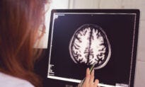 4 cosas que envejecen el cerebro y 6 formas de revertir el envejecimiento cerebral
