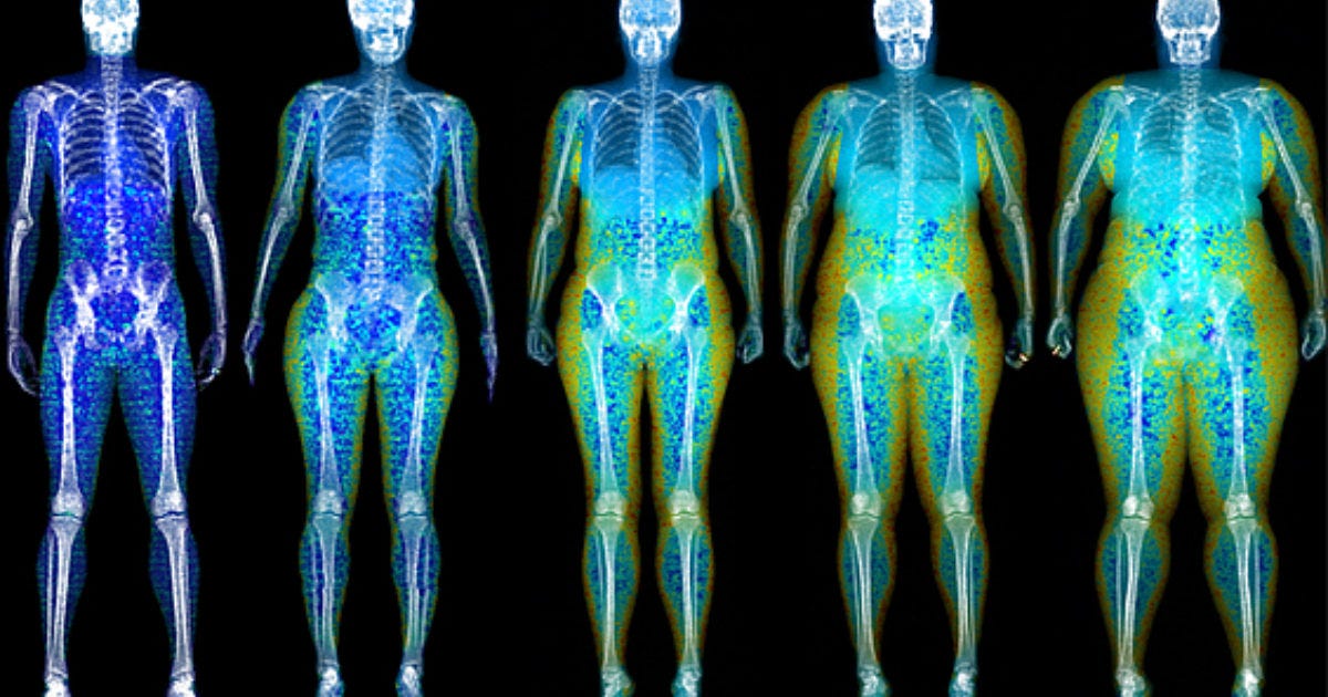 Body Composition | Radiology SA