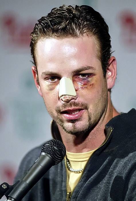 HARD-NOSED