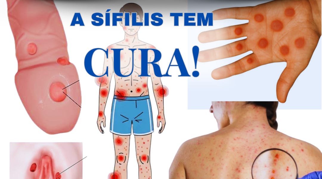 Sífilis: sintomas, tipos, transmissão e tratamento