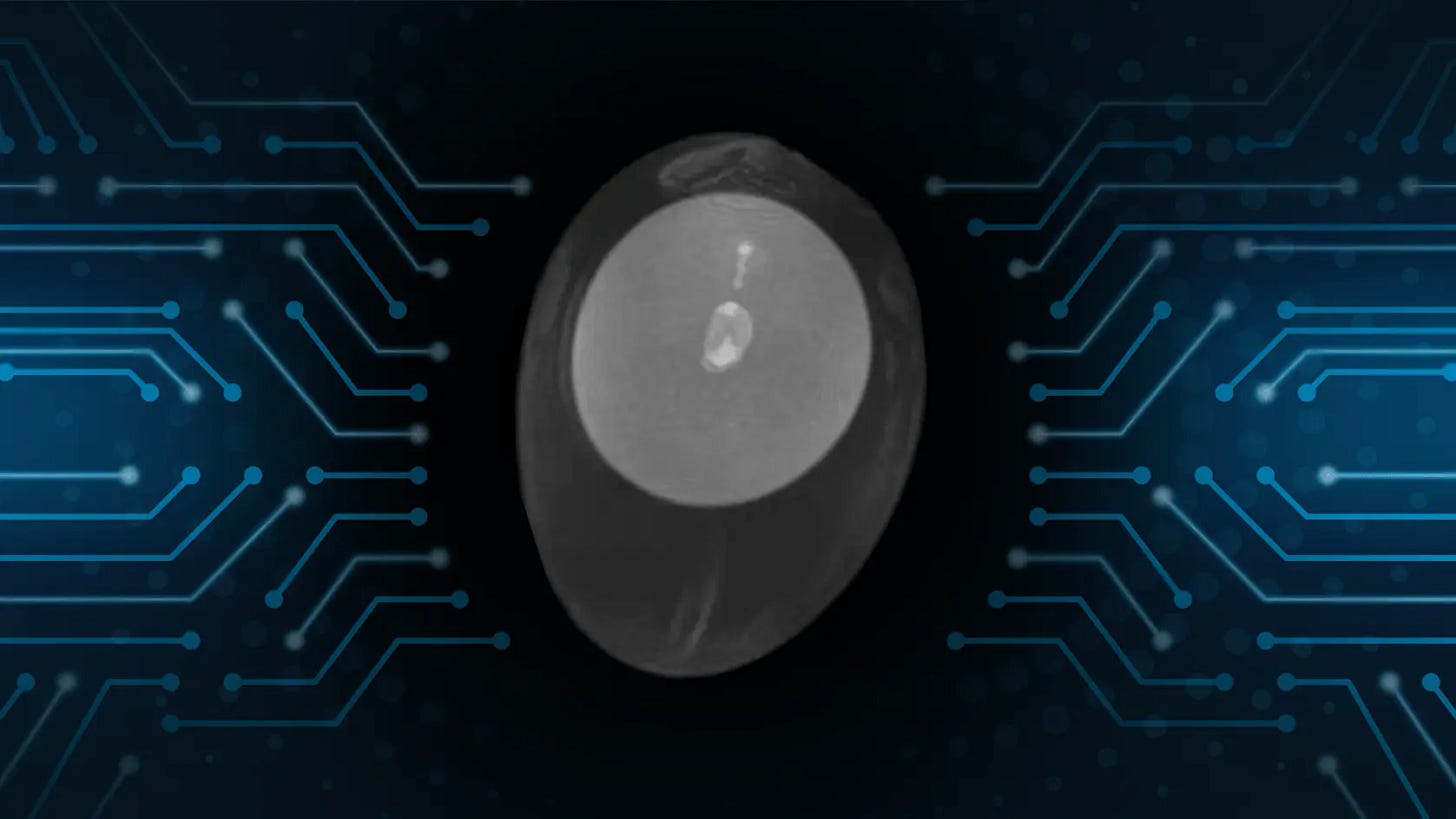 We revolutionize poultry_AI powered imaging