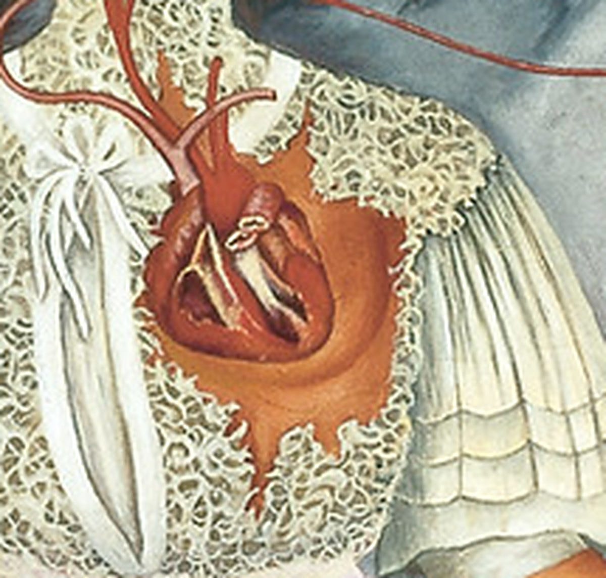 A heart cut clean in two with severed arteries, painted over torn white lace. A heart cut clean in two with severed arteries, painted over torn white lace.