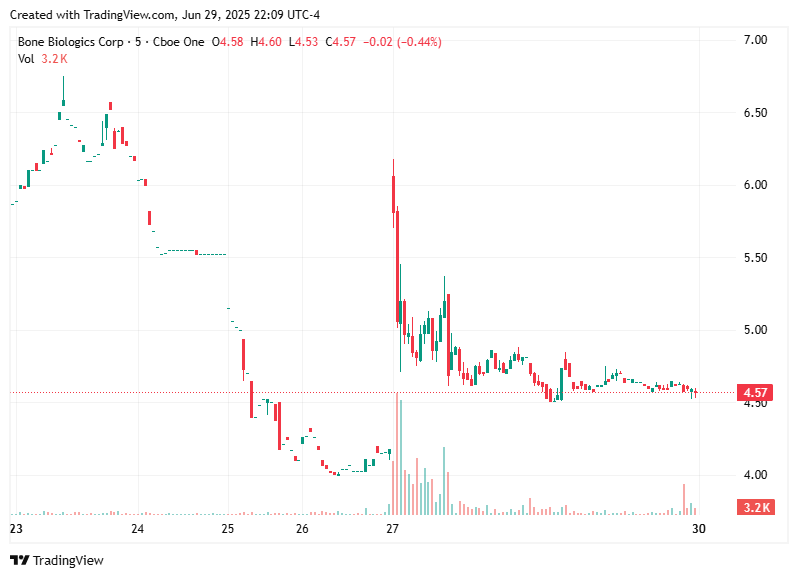 TradingView chart TradingView chart