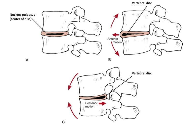 effects of spinal movements on the intervertebral disc