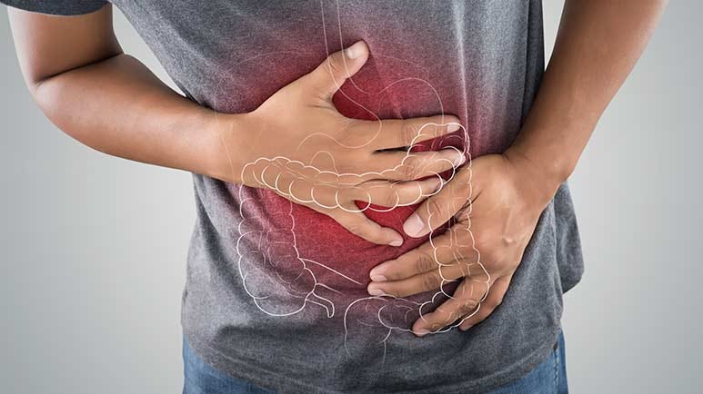 vitamin d deficiency linked to ibs