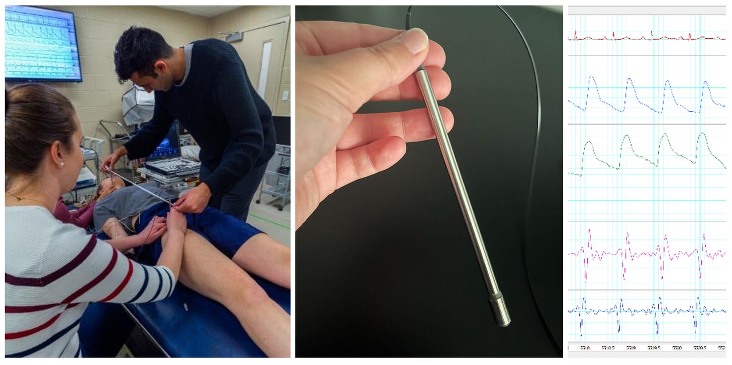 In this image, we are using the pen-like device on the left to see how fast a pulse travels through the body. We then measure the distance across the body to capture speed (velocity). The faster the pulse, the stiffer the arteries. In this image, we are using the pen-like device on the left to see how fast a pulse travels through the body. We then measure the distance across the body to capture speed (velocity). The faster the pulse, the stiffer the arteries.