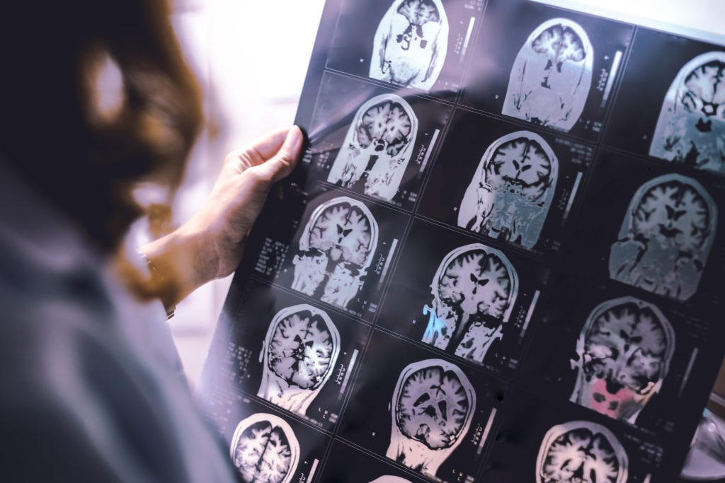 social brain