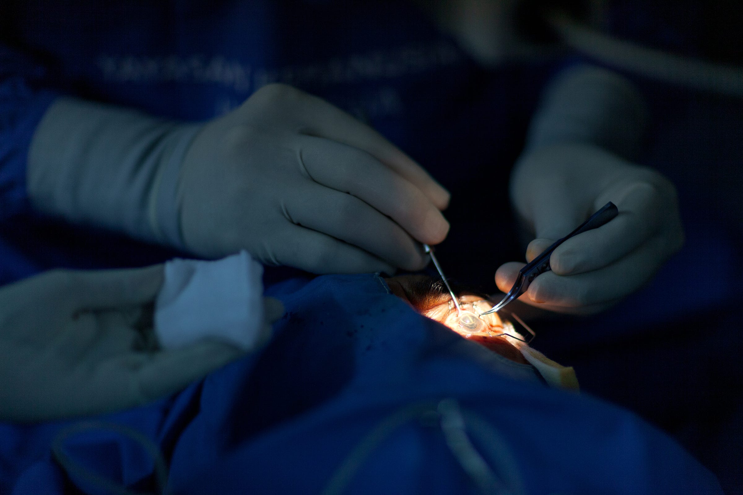 The incision is sealed and antibiotic drops are applied The incision is sealed and antibiotic drops are applied