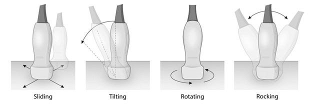 Troubleshooting FoCUS Image Acquisition: Patient Positioning, Transducer Manipulation, and Image Optimization Troubleshooting FoCUS Image Acquisition: Patient Positioning, Transducer Manipulation, and Image Optimization