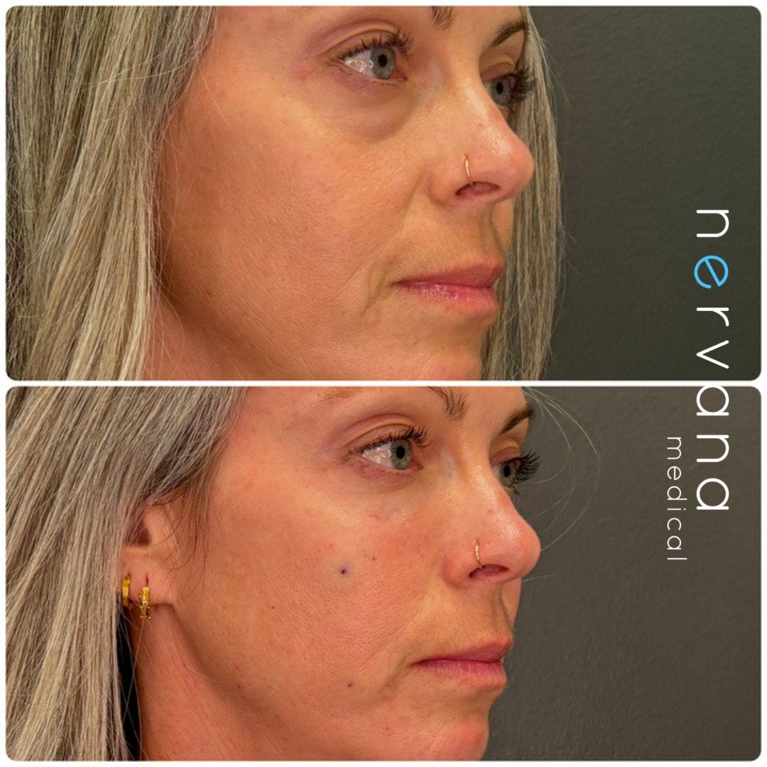 PRF/EZ Gel in Sandy, UT