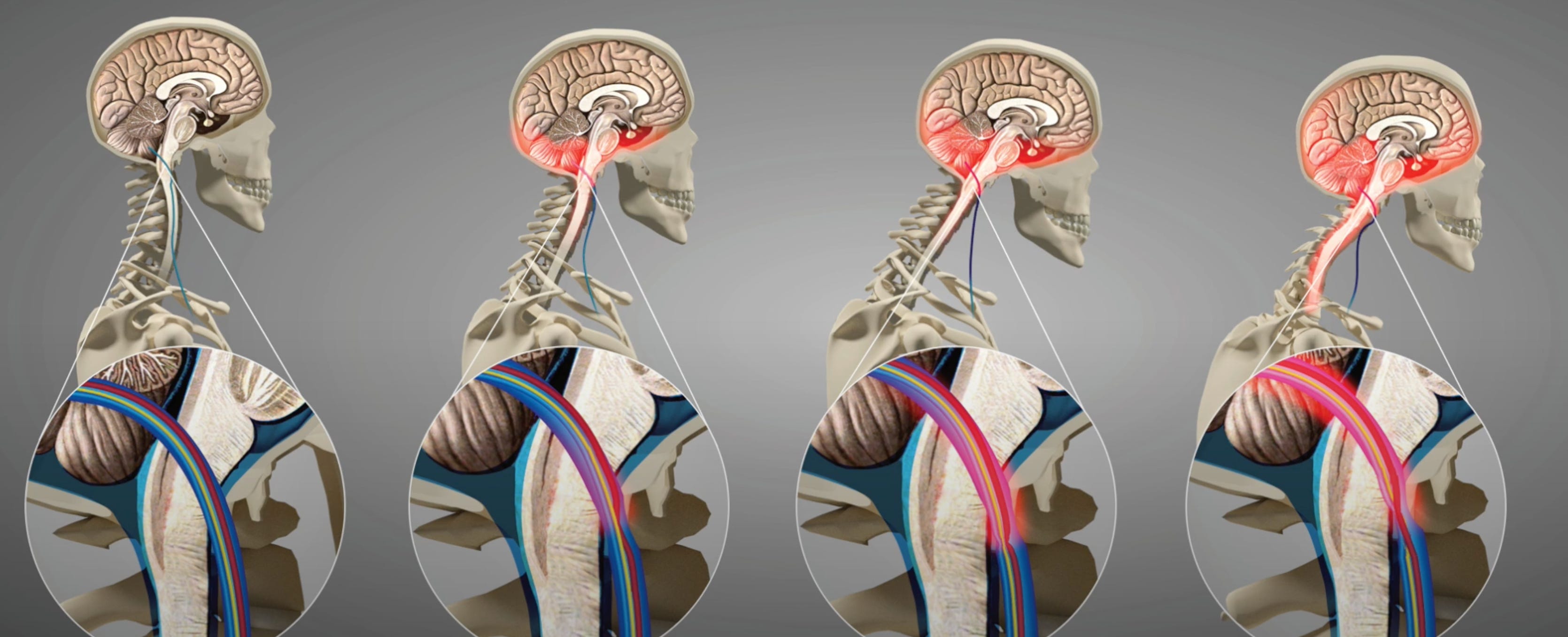 Neck Out Forward Fix Forward Head Posture: Boost Energy & Ease Neck Pain