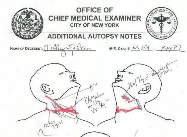 Jeffrey Epstein 'Suicide Note' Quietly Emerges