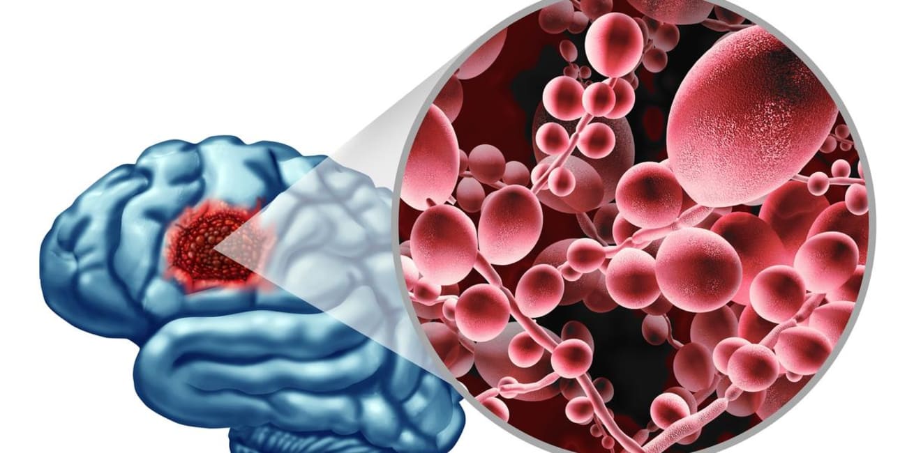 DEMENTIA & ALZHEIMER'S CURE: Fungal Infection in the Brain Produces Effects Similar to Alzheimer's