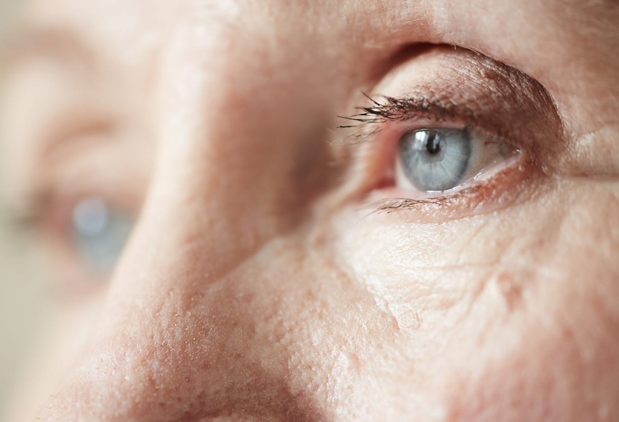 The Biggest Myth About Alzheimer’s Disease The Biggest Myth About Alzheimer’s Disease