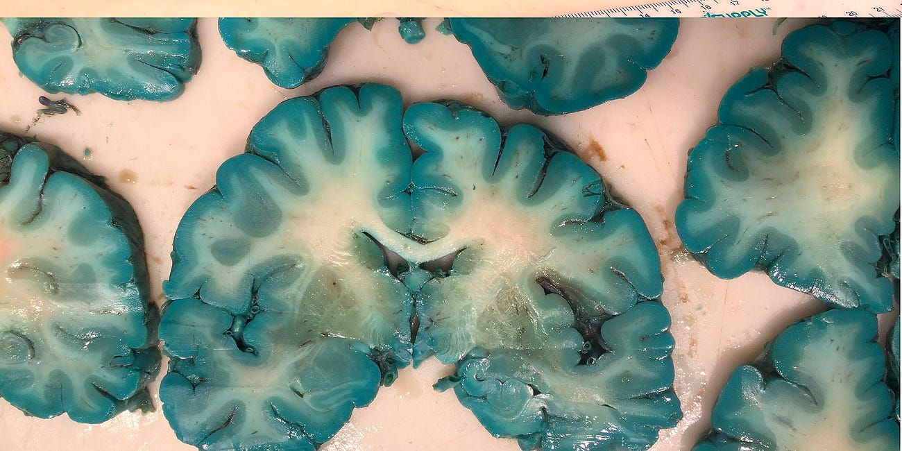 The Blue Brain Effect: Methylene Blue’s Dark Side & What You Should Be Using Instead